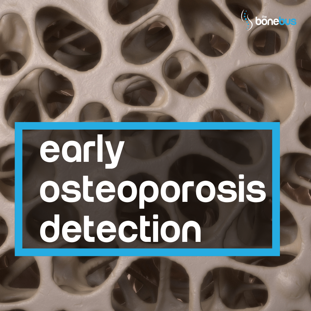 The DEXA Scan: Your Key to Early Osteoporosis Detection